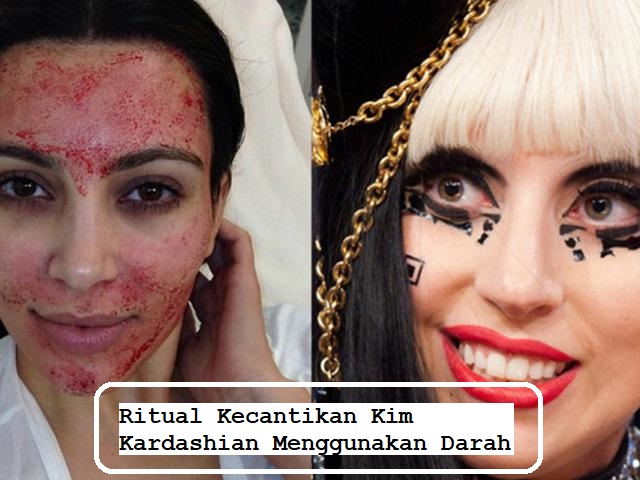 Ritual Kecantikan Kim Kardashian Menggunakan Darah